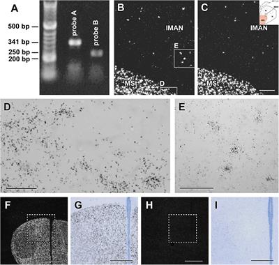 Brain Distribution and Sexually Dimorphic Expression of Amylin in Different Reproductive Stages of the Zebra Finch (Taeniopygia guttata) Suggest Roles of the Neuropeptide in Song Learning and Social Behaviour